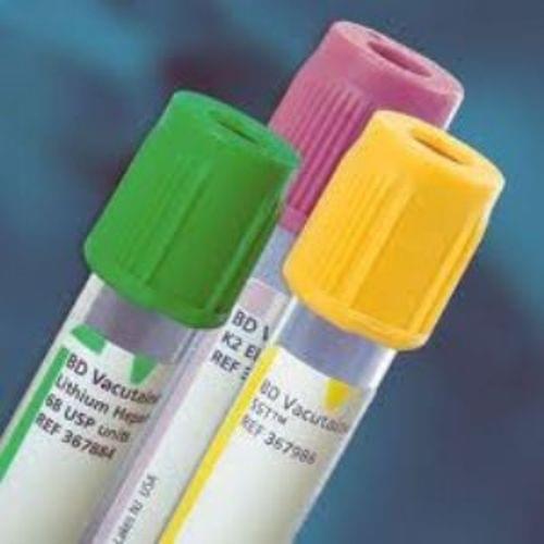 "Tube,whole blood,lvndr,add,13x100mm,6ml"