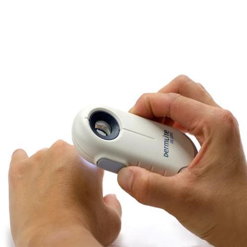 DermLite® DL100 Dermatology Dermascope - 201-DL100