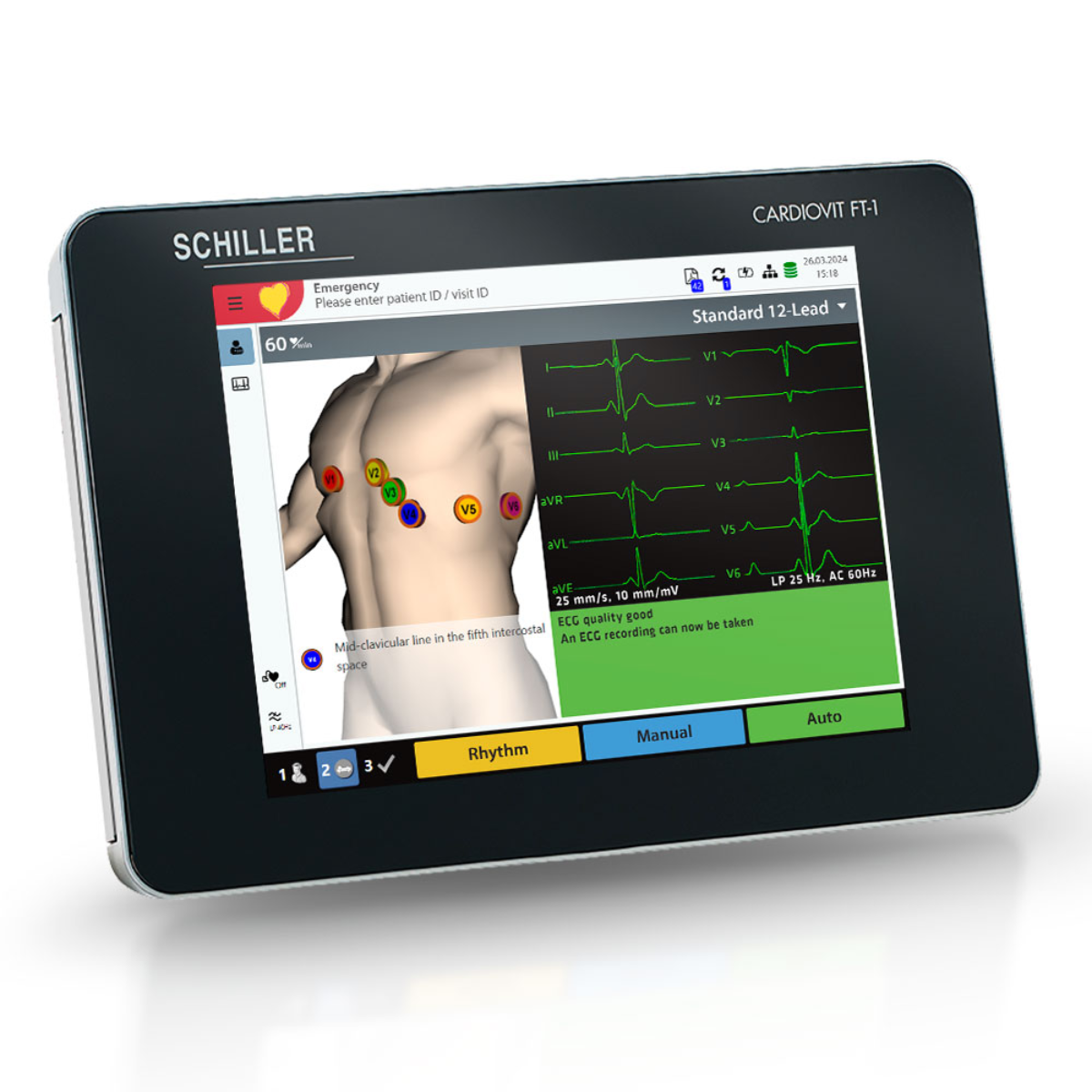 ECG Machines
