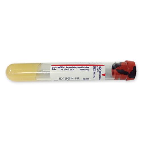 BD Vacutainer SST Tube Plastic Red/Grey 7.5 ml