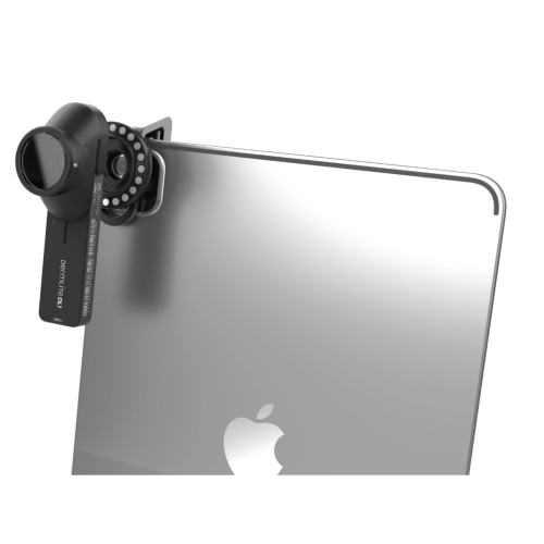 DermLite® DL1 Basic Smartphone Dermatoscope = 201-DL1B
