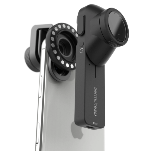 DermLite® DL1 Basic Smartphone Dermatoscope