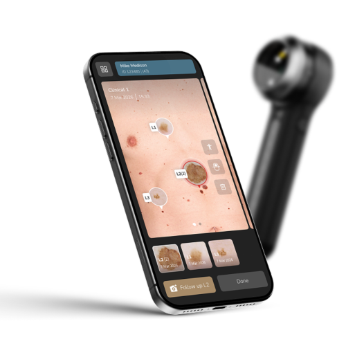 DermLite® DL5 Plus Dermatoscope = 201-DL5PLUS