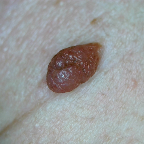 Firefly DE608 4K General Examination Camera for Telehealth and Telemedicine = 202-608