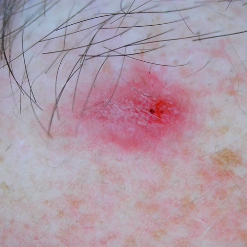 Firefly DE608 4K General Examination Camera for Telehealth and Telemedicine = 202-608