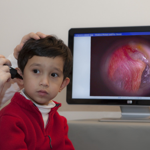 Firefly DE500 Wired Digital Video Otoscope = 202-700