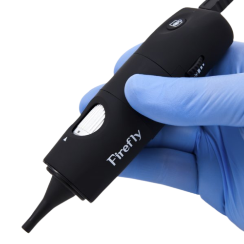 Firefly DE500 Wired Digital Video Otoscope