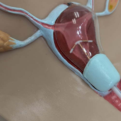 Anatomy Lab IUD Insertion Model I = 900-104452