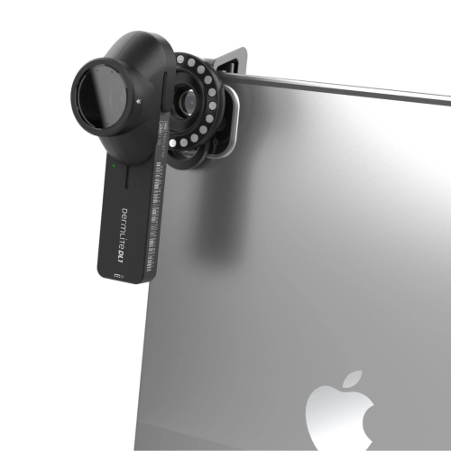DermLite DL1 Dermatoscope = 201-DL1