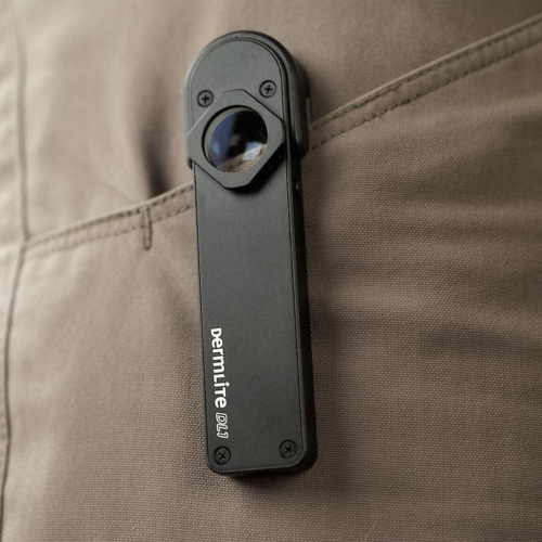 DermLite DL1 Dermatoscope = 201-DL1