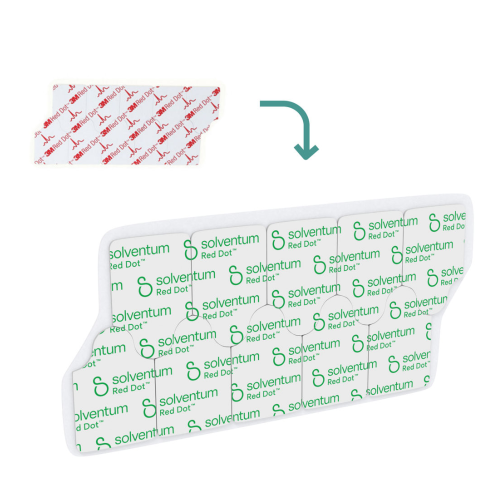 Solventum™ Red Dot™ Resting EKG Electrodes (formerly 3M™ Red Dot™) - Pack of 100 = 300-2330