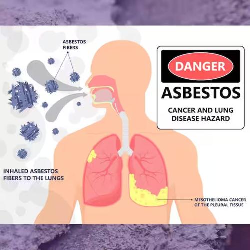 Asbestos Test Kit As108 Alt #1